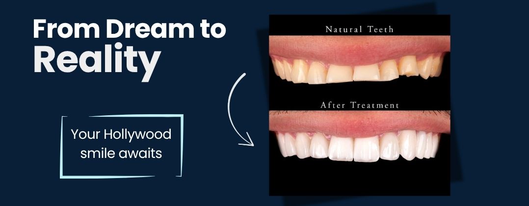 tailored-treatments-for-every-smile