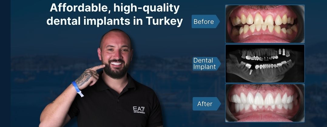 affordable-dental-care-premium-treatments-at-unbeatable-prices