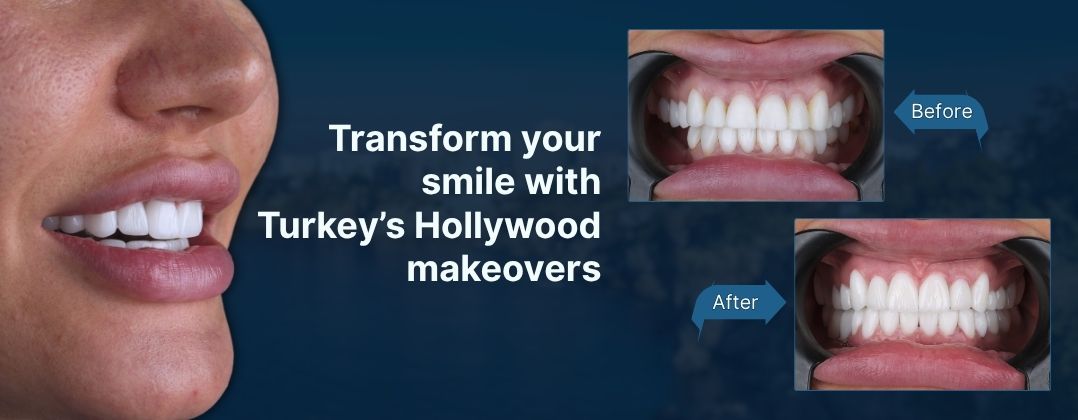 popular-dental-treatments-what-patients-love