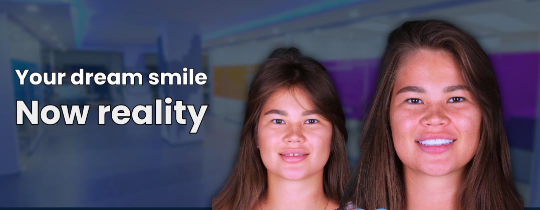 Before-and-after smile makeover at Myra Dental Center.